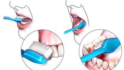 Peste 80% dintre români suferă de afecţiuni dentare