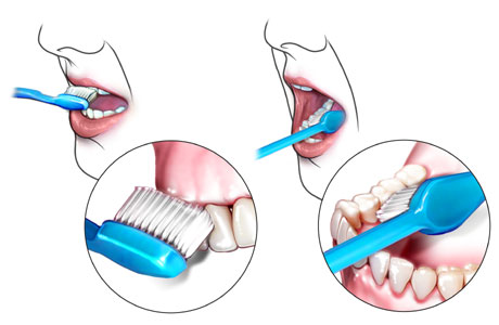 Peste 80% dintre români suferă de afecţiuni dentare