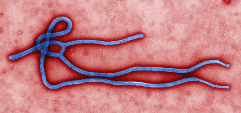 SUSPECT de Ebola la Constanța!