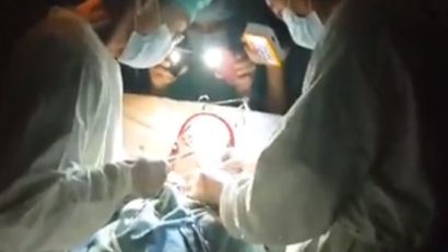 (VIDEO) Operaţie pe cord deschis, la lumina lanternelor!