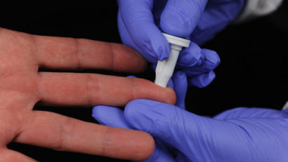Test rapid pentru depistarea Ebola