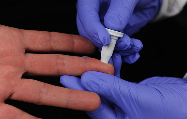 Test rapid pentru depistarea Ebola