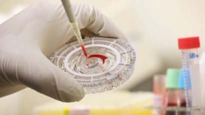 OMS anunţă un posibil tratament împotriva Ebola