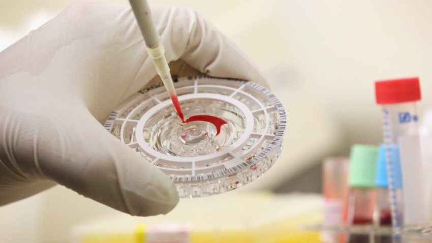 OMS anunţă un posibil tratament împotriva Ebola
