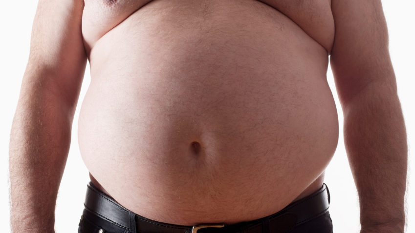 Aproape o treime din populaţia mondială este obeză sau supraponderală