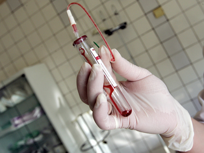 A început caravana naţională de informare şi prevenţie a hepatitei
