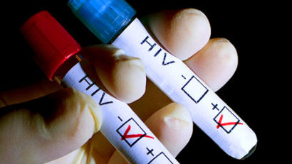 O treime din cei infectaţi cu HIV nu sunt conştienţi de boală
