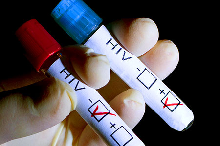 O treime din cei infectaţi cu HIV nu sunt conştienţi de boală