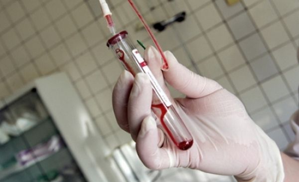 Lanţul infectărilor cu HIV, la Năvodari