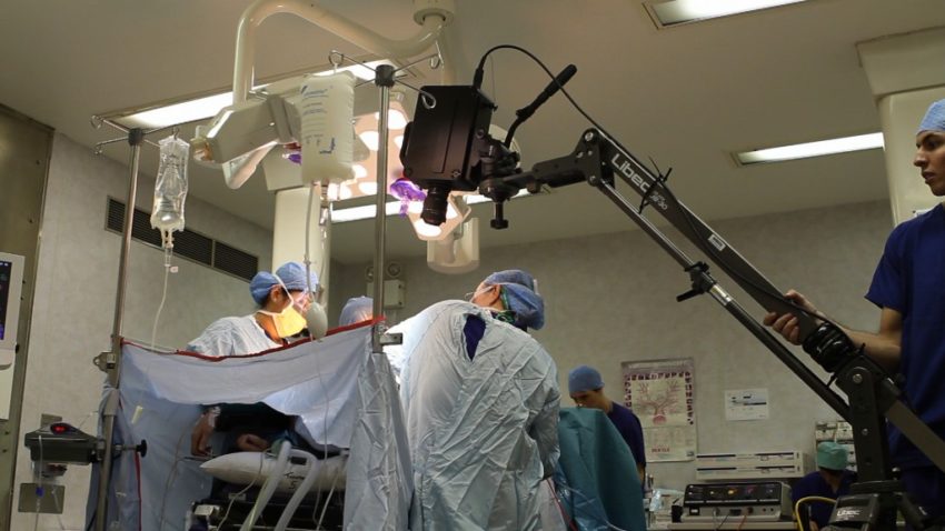 Operaţie cu cameră de 33 de milioane de pixeli