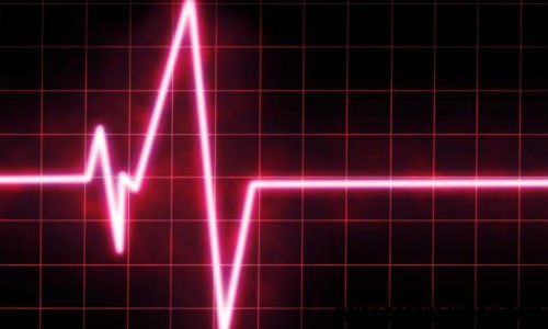 Program pilot pentru pacienţii în stop cardio-respirator
