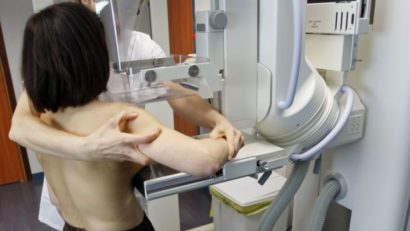 Ecografii mamare gratuite pentru femeile din Cumpăna
