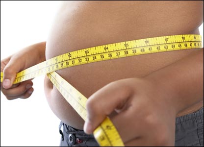 Obezitatea severă – considerată hadicap