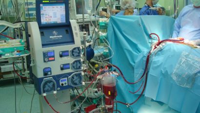 Primul termen în dosarul de mită de la Clinica de Chirurgie Cardiovasculară din Constanţa