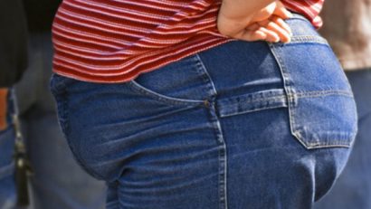 Bisturiul- singura soluţie pentru pacienţii cu obezitate morbidă