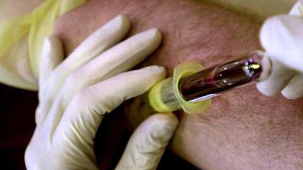 Terapii noi pentru hepatita C disponibile şi pentru pacienţii de la noi