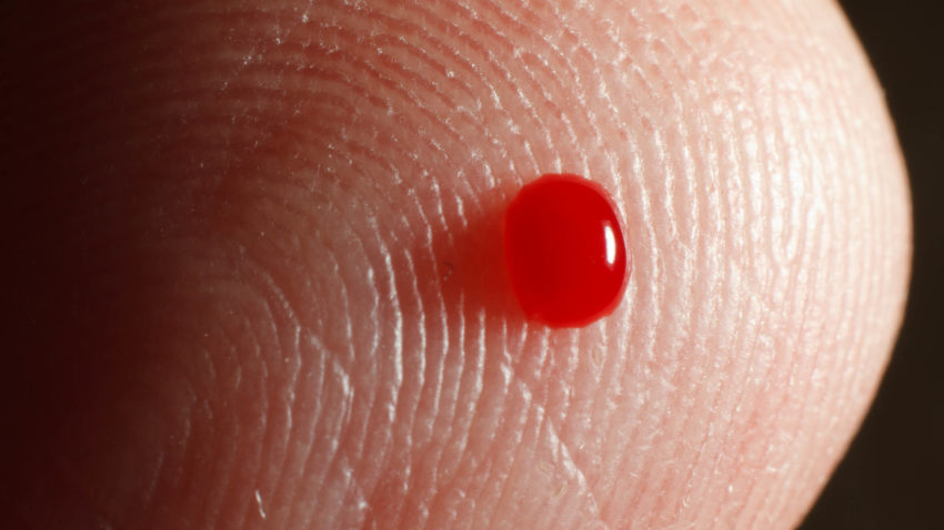 HIV şi sifilis, depistate cu ajutorul unui accesoriu pentru telefoanele inteligente