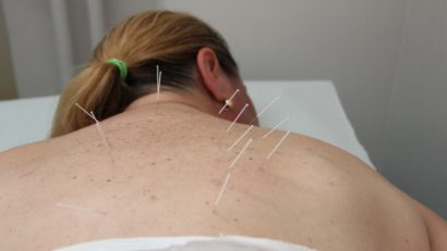 Tratamentele medicale chinezeşti, la mare căutare în Tulcea