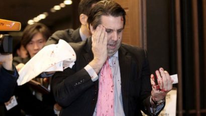 FOTO: Ambasadorul american la Seul a fost rănit într-un atac