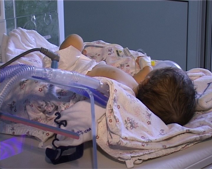 Doi copii din Fetești au fost diagnosticați cu sindrom hemolitic uremic