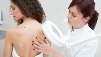 Vine vara ! Consultaţii dermatologice gratuite, expunere moderată la soare