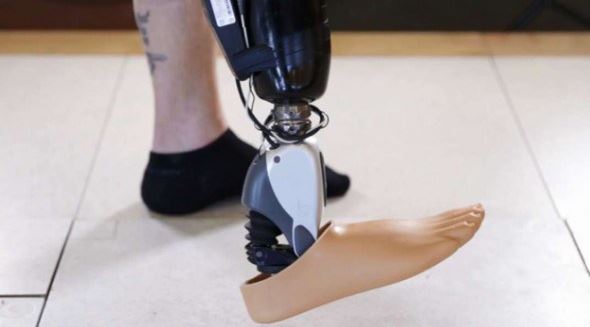Revoluţie în protetica medicală. Primul picior artificial comandat cu puterea minţii