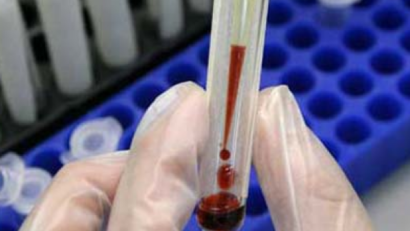 Atenție! Hepatita C a omorât anul trecut 1200 de români