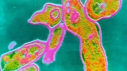 Efectele refuzului vaccinării: în Spania a reapărut o boală foarte gravă