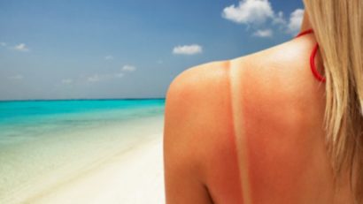 Consultaţii dermatologice gratuite pe litoral