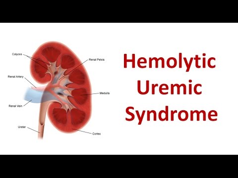 Fetiţa din Covasna nu are sindrom hemolitic-uremic