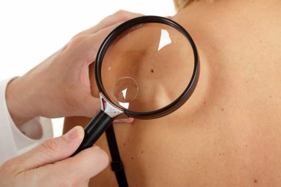 CONSTANȚA: Liceenii primesc consultaţii gratuite şi informaţii cu privire la cancerul de piele
