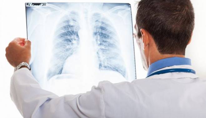 Noi şanse pentru pacienţii cu cancer pulmonar
