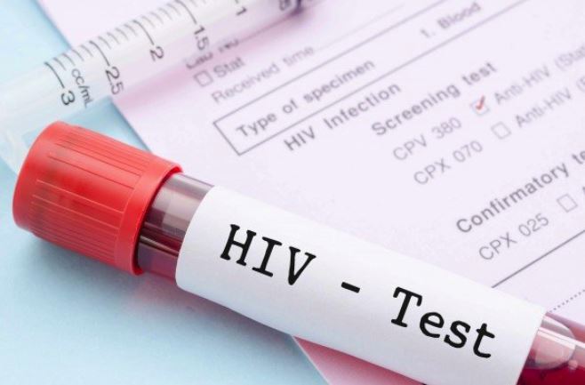 „Cunoaște-ți statusul HIV!“ Testarea este esențială pentru prevenirea răspândirii infecției, spun specialiștii
