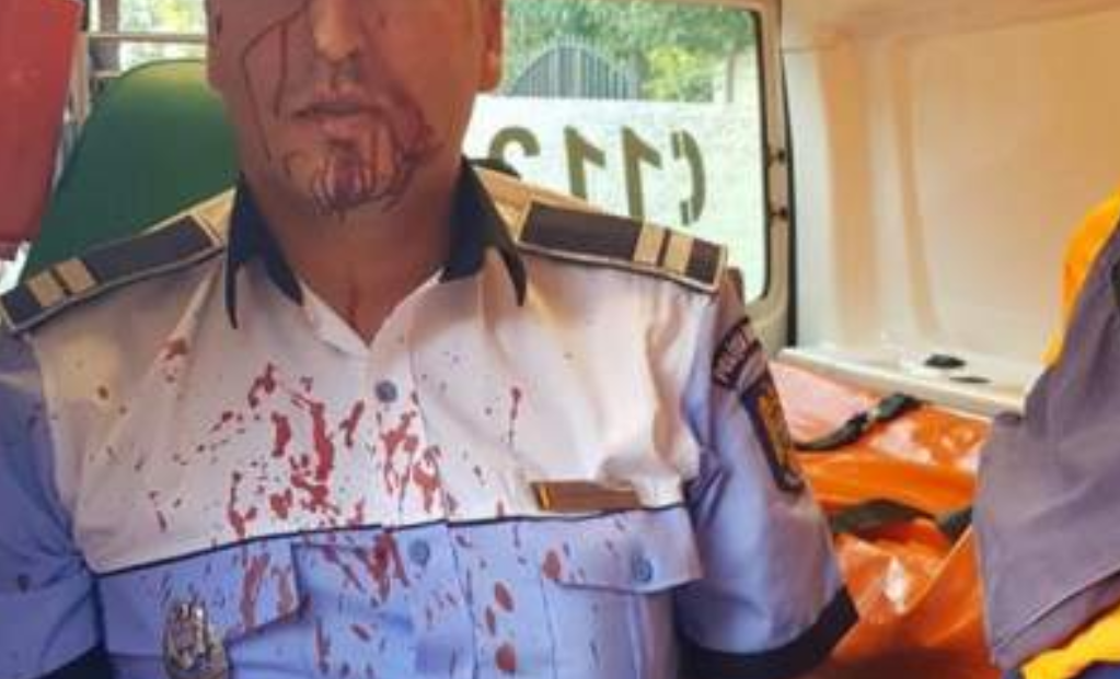 Poliţist de la Serviciul Rutier, lovit în cap de un şofer care efectuase o depăşire neregulamentară