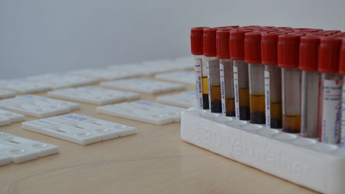 DOBROGEA: Anul trecut au fost depistate 48 noi cazuri de infecţie cu HIV