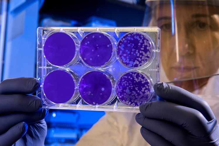 Peste 100 de cazuri de coronavirus confirmate în Italia
