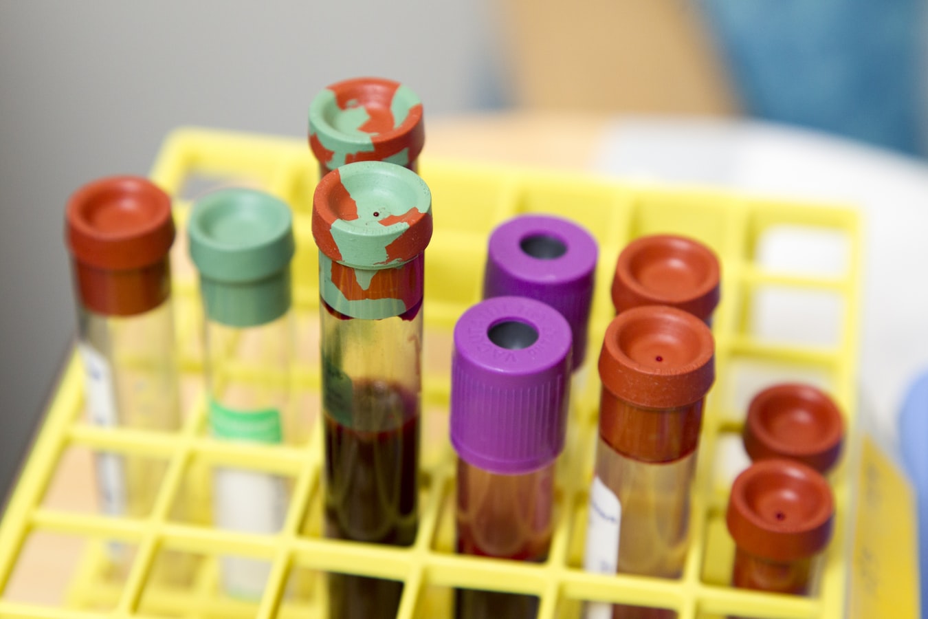 Ministerul Sănătăţii: 4.854 de cazuri noi de COVID-19; rata de infectare în Capitală – în scădere