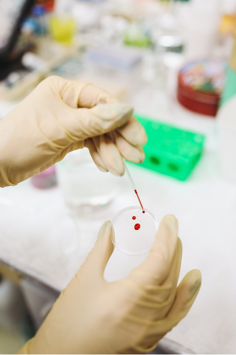 Persoanele neasigurate medical, acces la testarea pentru viruşii hepatici B, C şi HIV şi la terapiile specifice. Legea a fost promulgată de preşedintele Iohannis