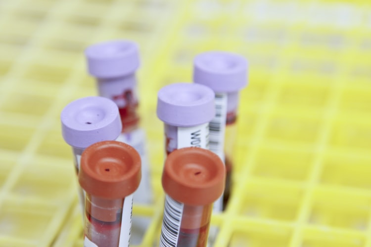 ARAD: Un pacient a fost confirmat infectat cu hantavirus