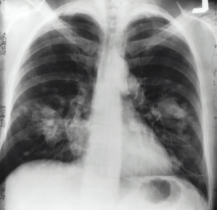 Cercetătorii de la Laserul din Măgurele propun o soluție pentru diagnosticarea cât mai timpurie a îmbolnăvirii cu COVID-19