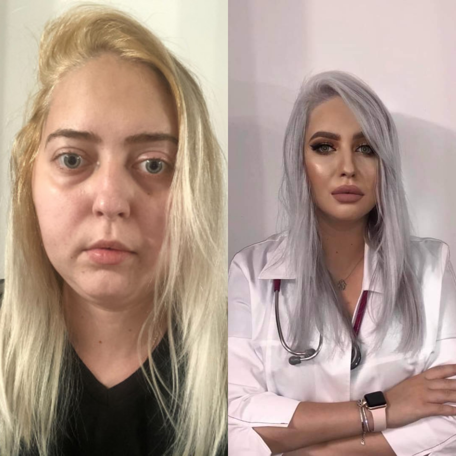 Apel umanitar! Diana, absolventă a Facultății de Medicină de la Universitatea „Ovidius” din Constanța, are nevoie de ajutor. Cancerul a recidivat într-o formă mult mai agresivă