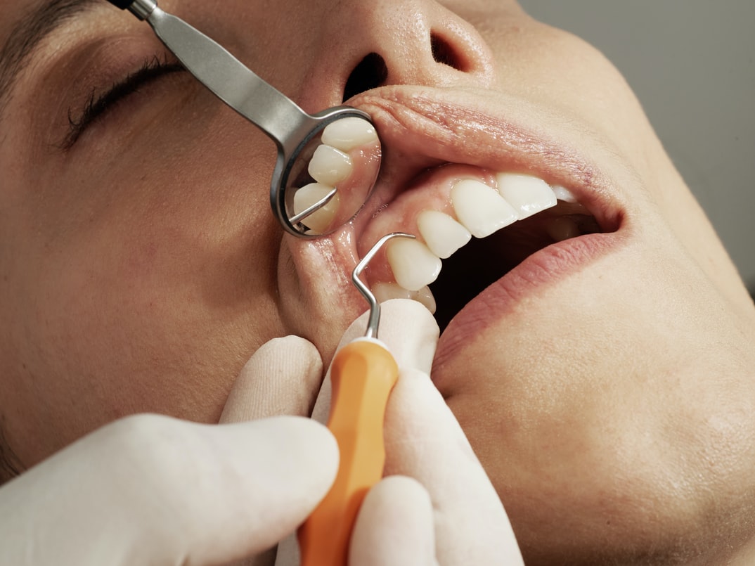 TULCEA: Lipsă de medici stomatologi în localitățile din Delta Dunării
