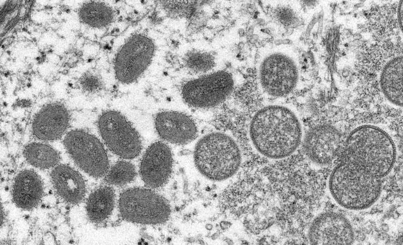 Vaccinul împotriva variolei maimuţei oferă o protecţie de 78%, arată un studiu britanic
