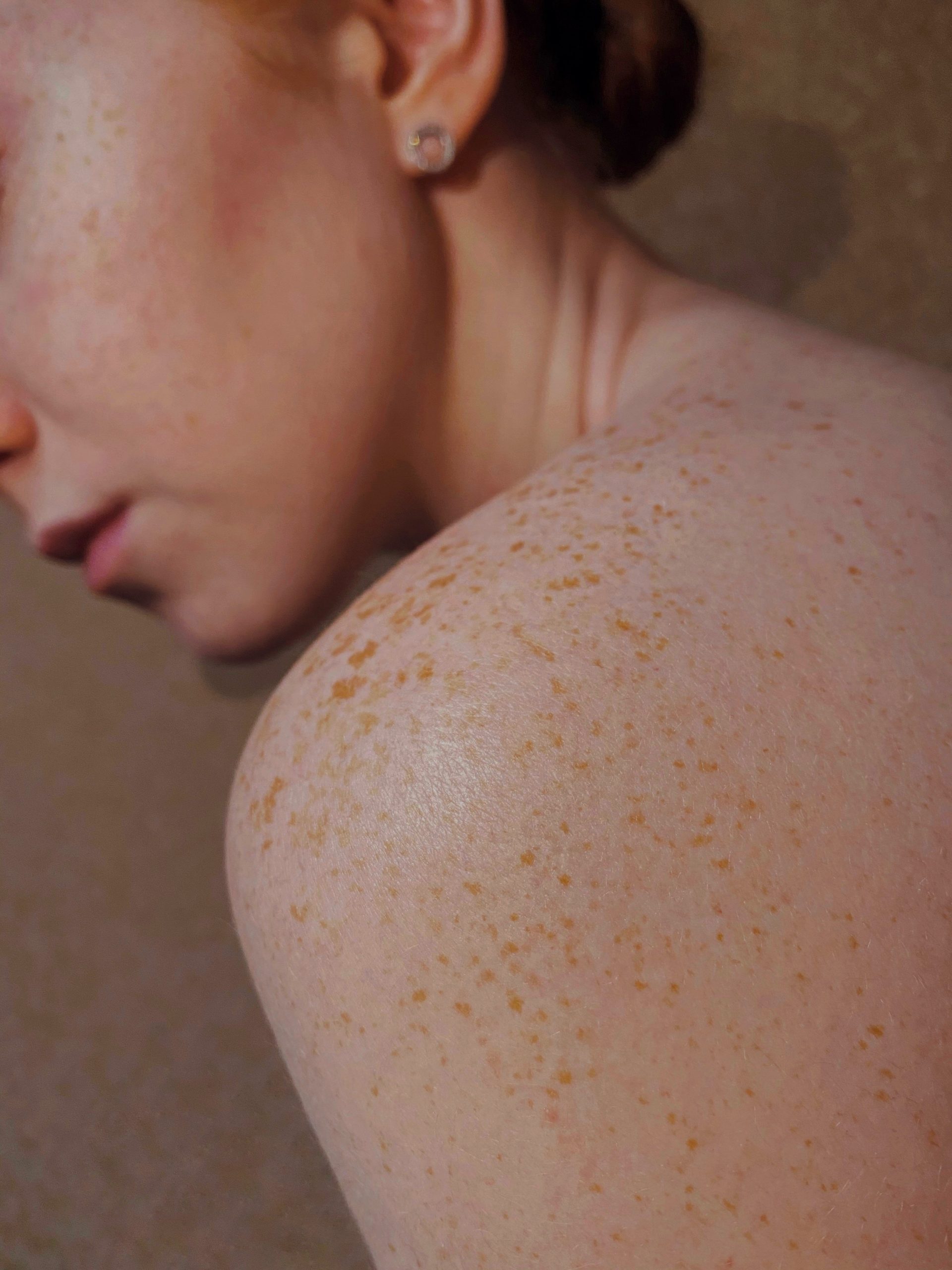 Investigații dermatologice gratuite pentru constănțenii și turiștii aflați pe litoral