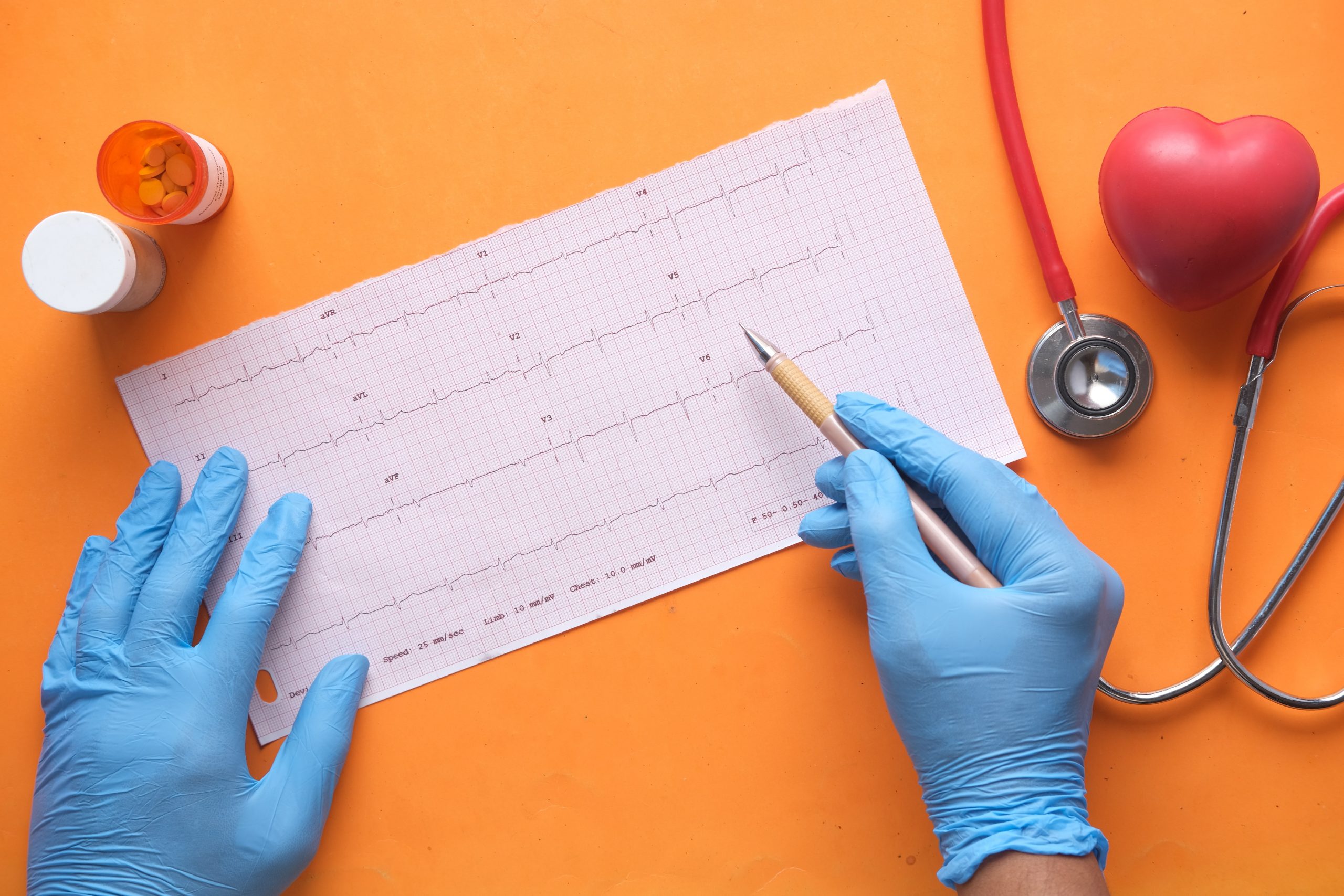 STUDIU: Unele persoane care au făcut COVID ar putea prezenta un risc ridicat de probleme cardiace