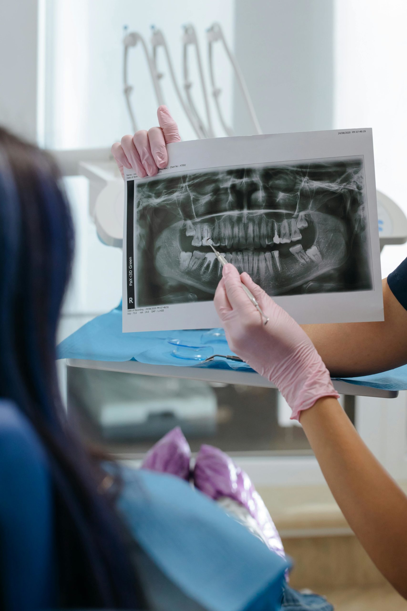 stomatolog, radiografie dentara, dinti - foto - pexels