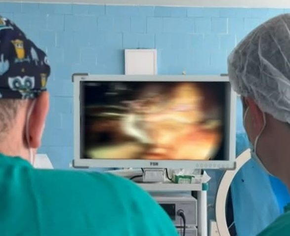Premieră medicală la Galați: Rinichi îndepărat prin intervenție laparoscopică