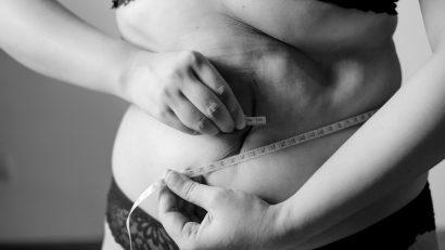 Endocrinologii atrag atenția că sintagma “mănâncă mai puțin, mișcă-te mai mult” este depășită în anumite cazuri