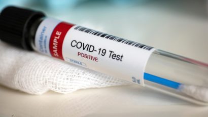 Peste 3.800 de noi cazuri de COVID-19 și un deces, în perioada 18 – 24 august