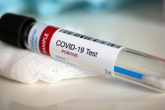 Val epidemic de COVID-19 în creștere: Peste 5.000 de noi cazuri și 11 decese, săptămâna trecută